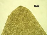 Dettaglio delle cellule apicali